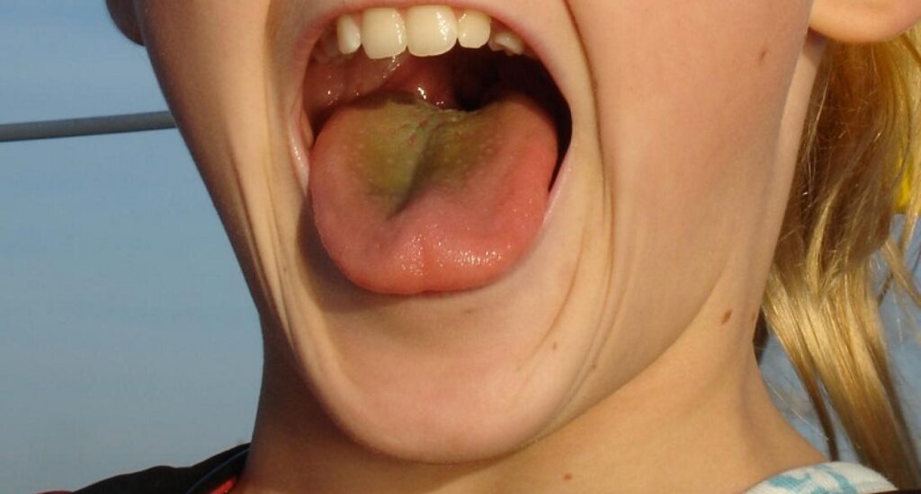 Why is my tongue greenish yellow?